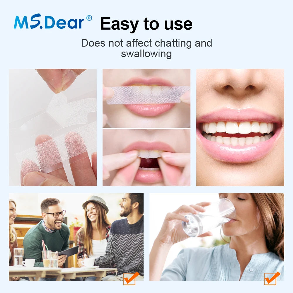 **Bandes Blanchiment Dentaire 9D Gel – Sourire Éclatant**